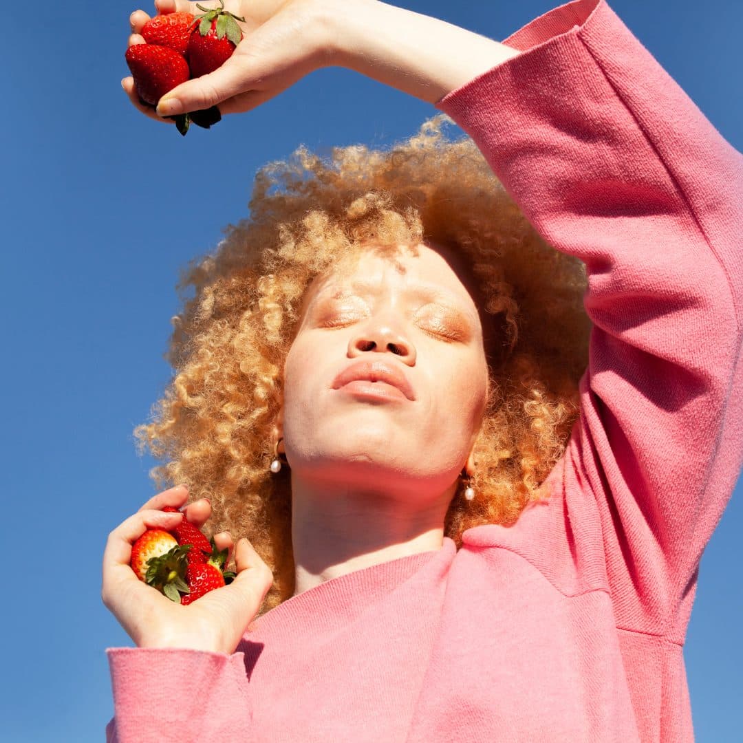 A woman with Albinism holding a bunch of strawberries as she faces the sun.